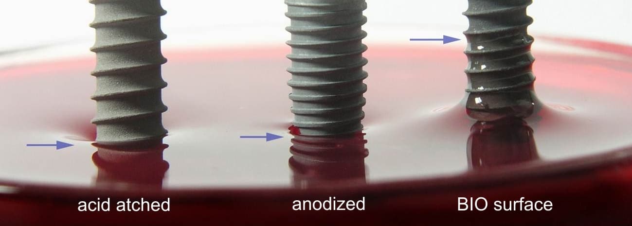 Wettability comparison of acid-etched, anodized and BIO surface titanium implants
