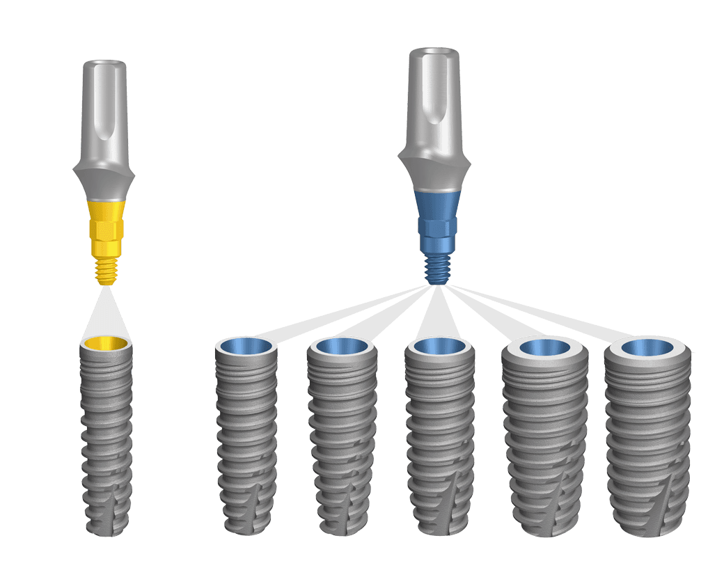 BioniQ prosthetic components for individualized restorations