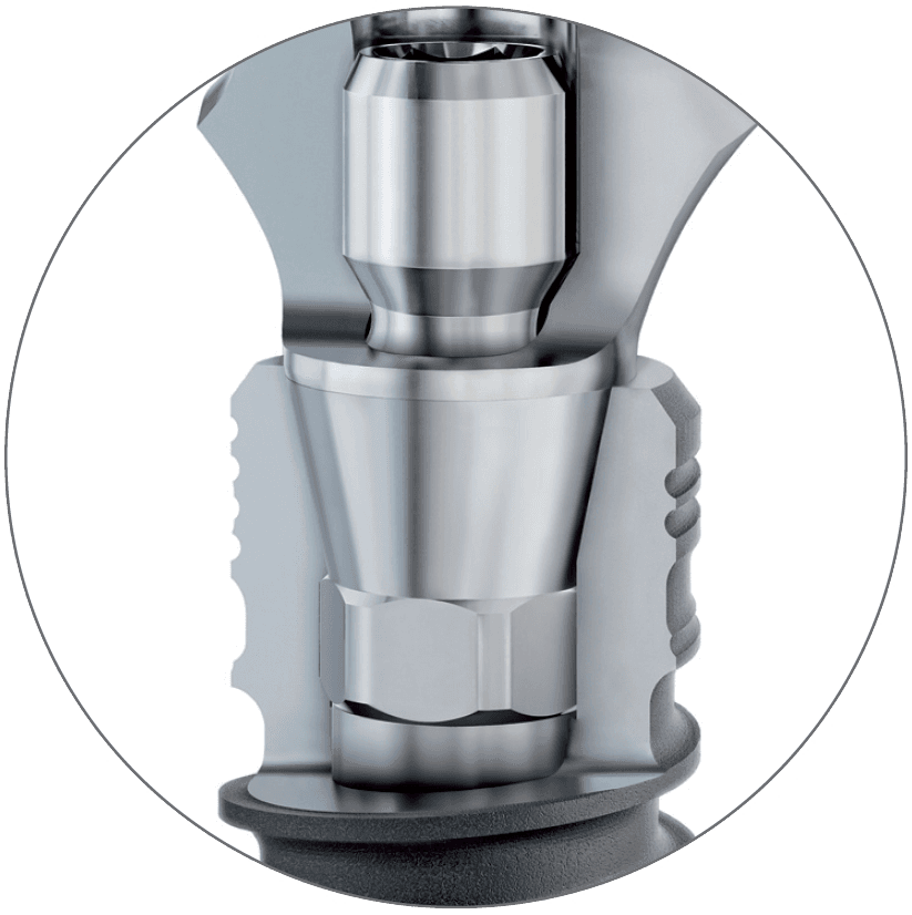 Cross-section of the BioniQ Q-Lock implant-abutment connection